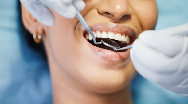 Best Urgent Care for Lost Fillings or Crowns in Odessa, FL